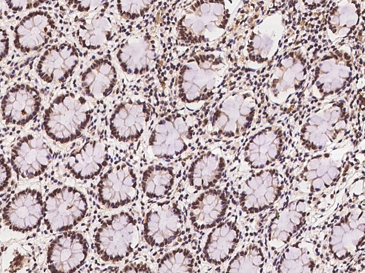 Polyclonal Rabbit anti-Human C11orf46 Antibody (IHC)