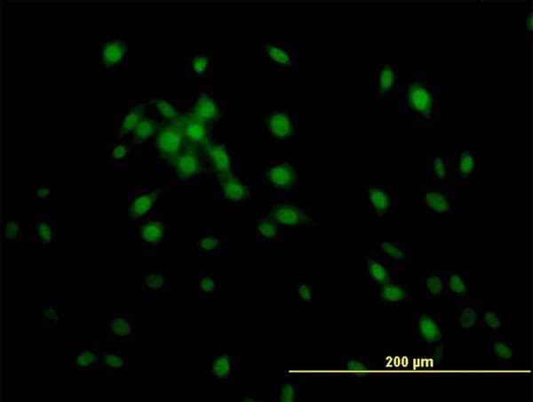 IHC-plus™ KLF11 Antibody (clone 10D8)
