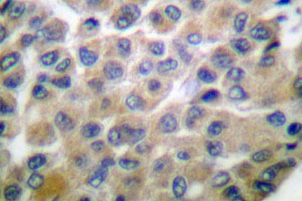Polyclonal Rabbit anti-Human MMP8 Antibody (Phe445, IHC, WB)