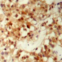 Polyclonal Rabbit anti-Human FOXO3 / FOXO3A Antibody (phospho-Ser253, IHC, IF, WB)