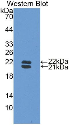 HP / Haptoglobin Antibody (aa118-281)