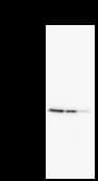 DDX3 / DDX3X Antibody (clone 2253C5a)