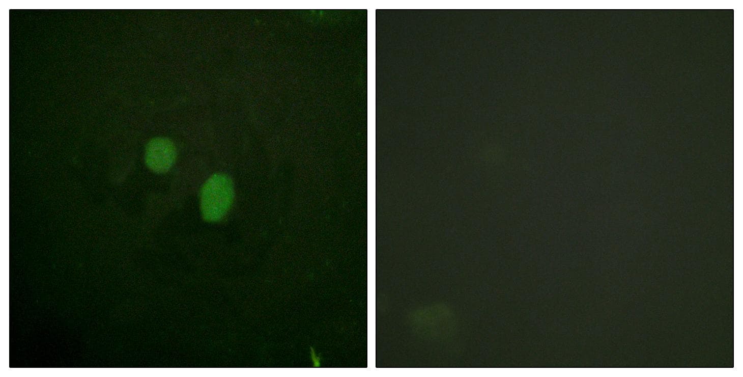Polyclonal Rabbit anti-Human HMGN2 Antibody (IHC, IF)