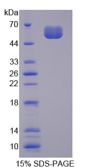 Mouse SOST / Sclerostin Protein (Recombinant His-GST)