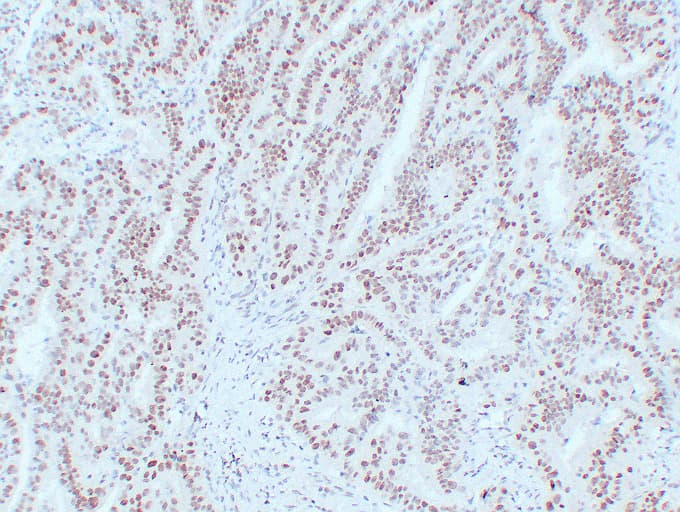 Monoclonal Mouse anti-Human MLH1 Antibody (clone ABT-MLH1, IHC, WB)