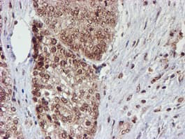 CYP17 / CYP17A1 Antibody (clone OTI3F11)