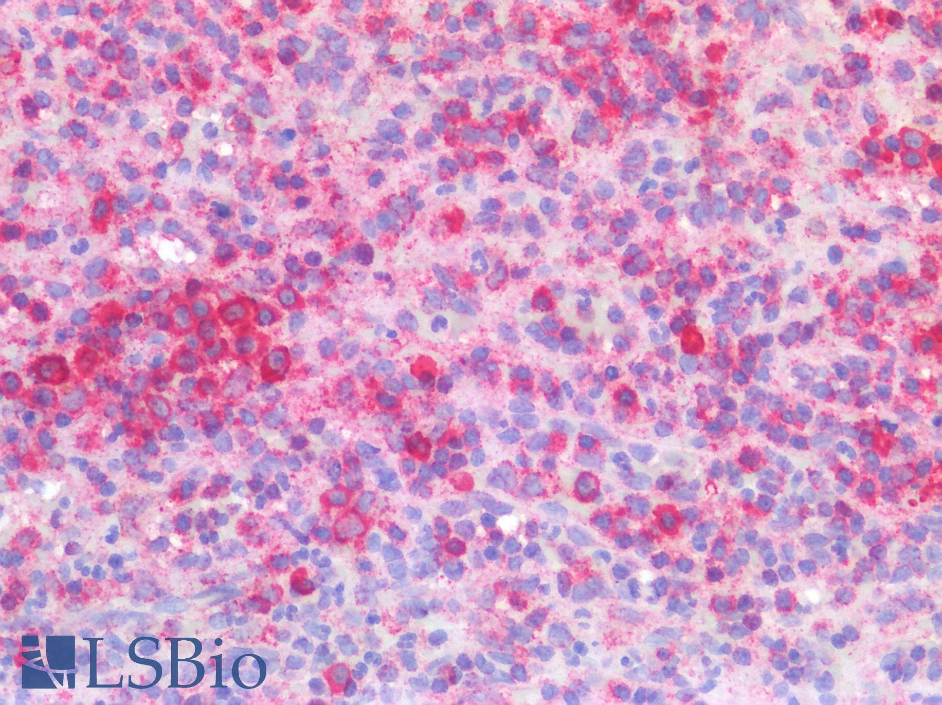 PathPlus™ IFNAR1 / IFNAR Antibody (clone 1H2)
