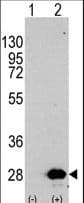 HSPB1 / HSP27 Antibody (Ser82)