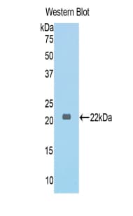 COL6A1 / Collagen VI Alpha 1 Antibody (aa624-800)