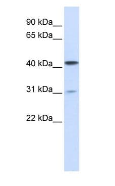 Polyclonal Rabbit anti-Human TMPRSS11D / HAT Antibody (aa288-337, IHC, WB)