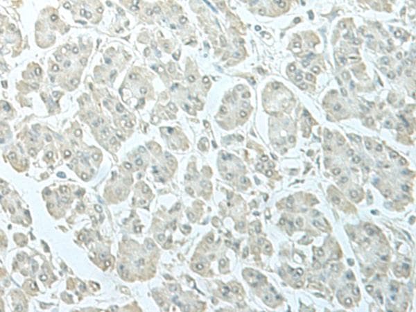 Polyclonal Rabbit anti-Human C8orf4 Antibody (IHC)