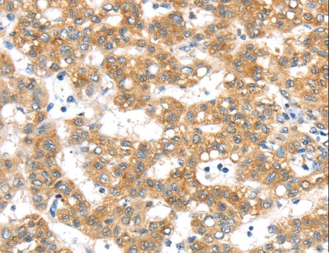 PTPMEG / PTPN4 Antibody