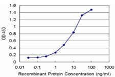 SNAI2 / SLUG Antibody (clone 2E10)