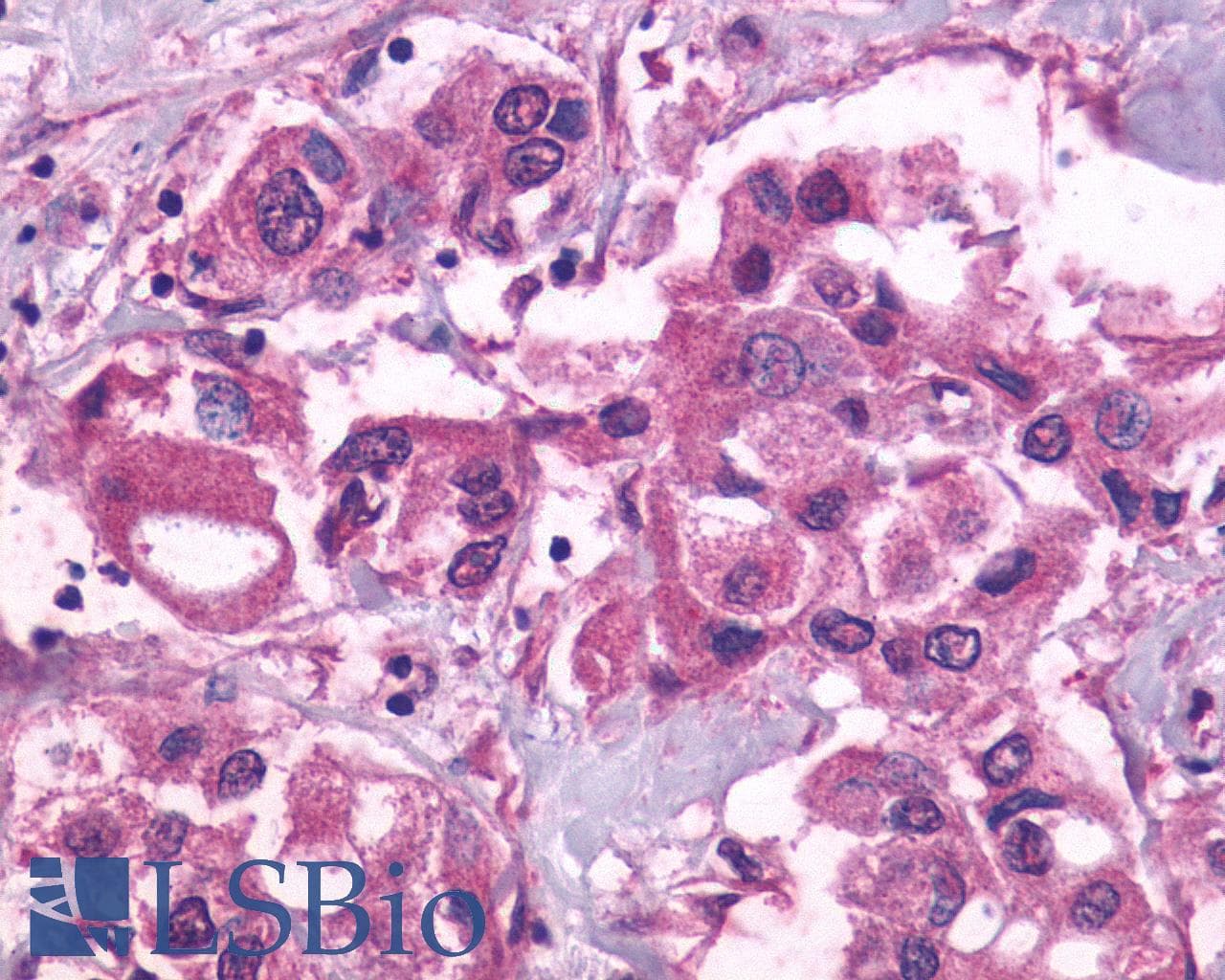 PathPlus™ FP / PTGFR Antibody (Extracellular Domain)