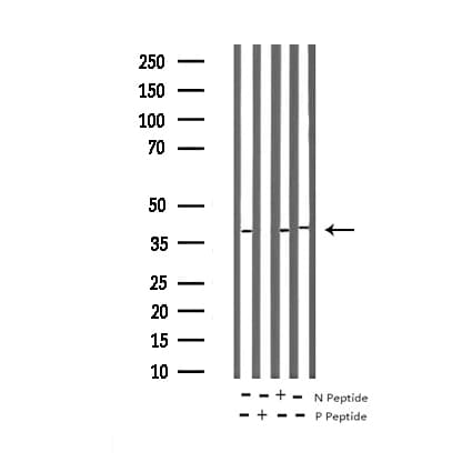 PRKAB1 / AMPK Beta 1 Antibody (phospho-Ser181)