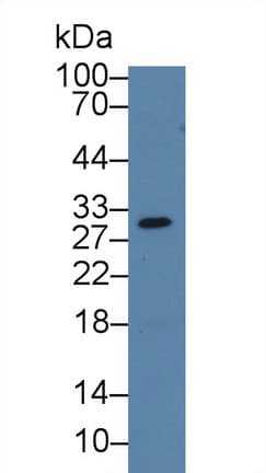 LGALS12 / Galectin 12 Antibody (aa119-311)