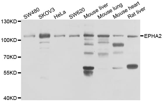 EPHA2 / EPH Receptor A2 Antibody