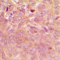 Polyclonal Rabbit anti-Human RPSA / Laminin Receptor Antibody (Internal, IHC, WB)