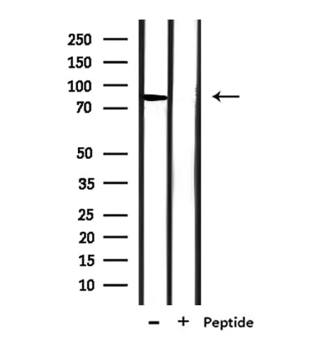 SLC6A17 Antibody