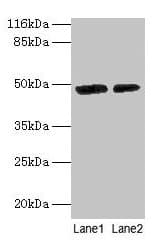 IHC-plus™ Polyclonal Rabbit anti-Human CALR / Calreticulin Antibody (aa 18-417, IHC, WB)