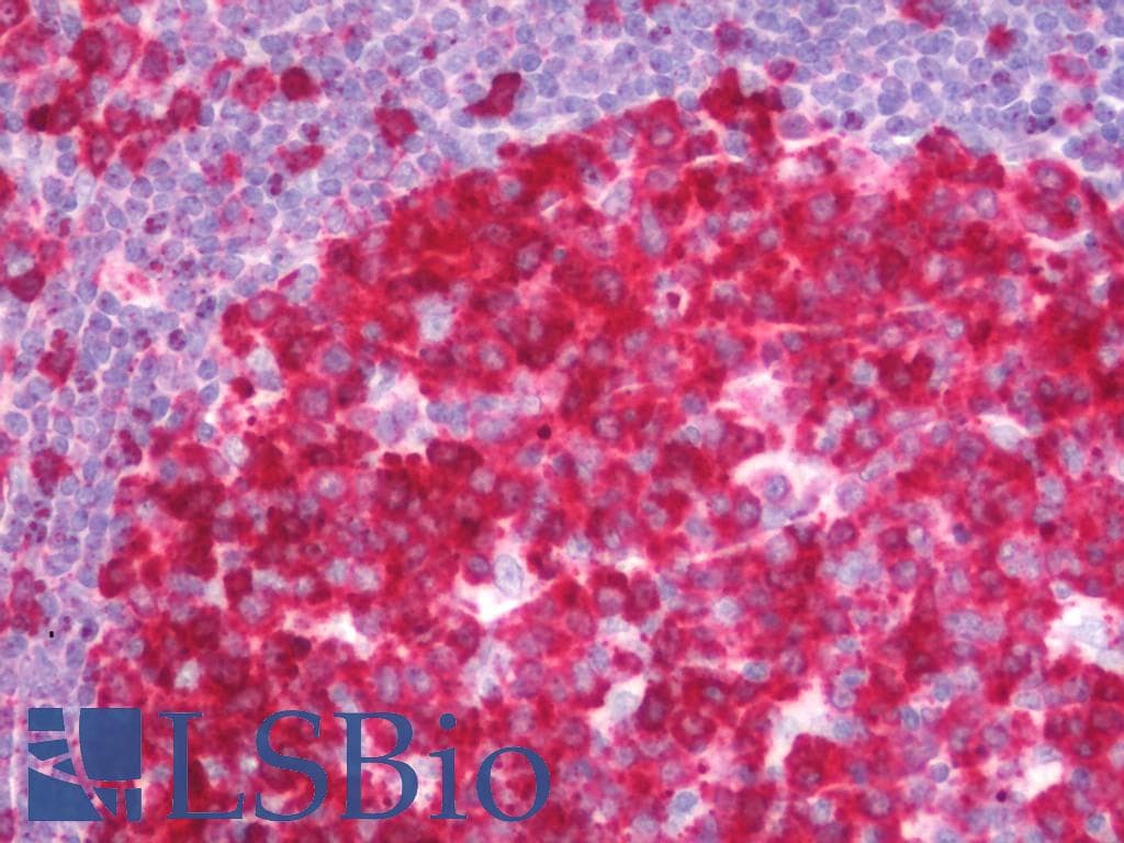 IHC-plus™ PDCL3 Antibody