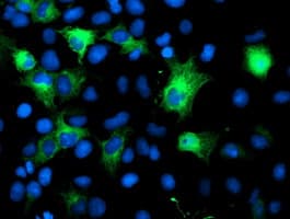 CRYAB / Alpha B Crystallin Antibody (clone OTI5D8)