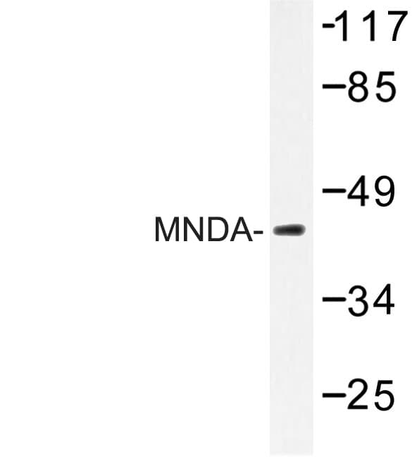 Polyclonal Rabbit anti-Human MNDA Antibody (Val406, IHC, WB)
