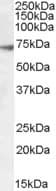 PathPlus™ GABRA4 Antibody (aa349-361)