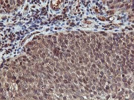 AKT1 Antibody (clone OTI4E10)