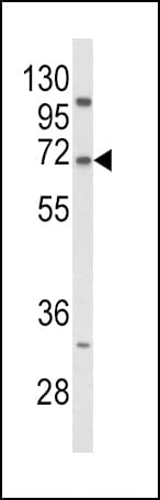 Polyclonal Rabbit anti-Human PCSK9 Antibody (aa144-173, IHC, WB)