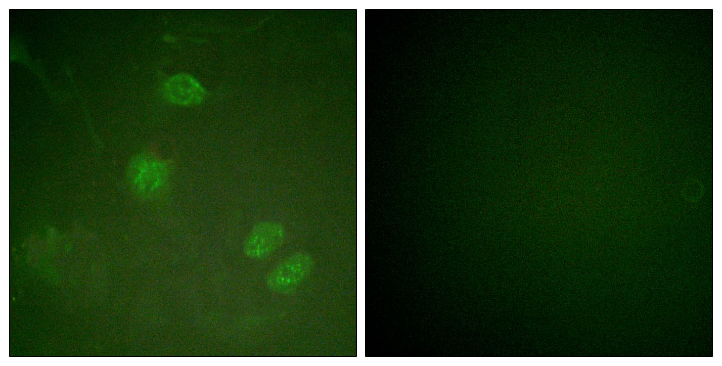 IHC-plus™ ELK3 / NET Antibody (aa323-372)