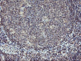 AGPAT5 Antibody (clone OTI1D4)