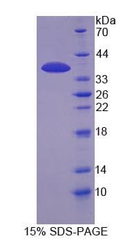 Human IP6K1 Protein (Recombinant His-S)