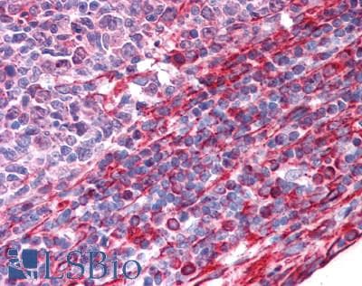 IHC-plus™ Polyclonal Rabbit anti-Human KDM3B / JMJD1B Antibody (IHC, IF, WB)