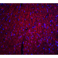 ARID1A / BAF250 Antibody