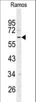 RIPK3 / RIP3 Antibody (aa1-30)