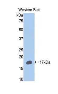 Polyclonal Rabbit anti-Human CYP2E1 Antibody (aa379-493, WB)
