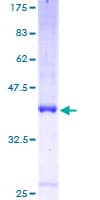 Human SLC1A7 / EAAT5 Protein (Recombinant GST)