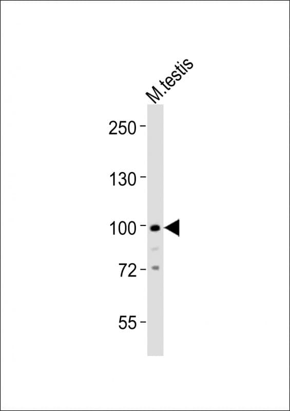 Polyclonal Rabbit anti-Mouse MED15 / ARC105 Antibody (aa712-746, WB)