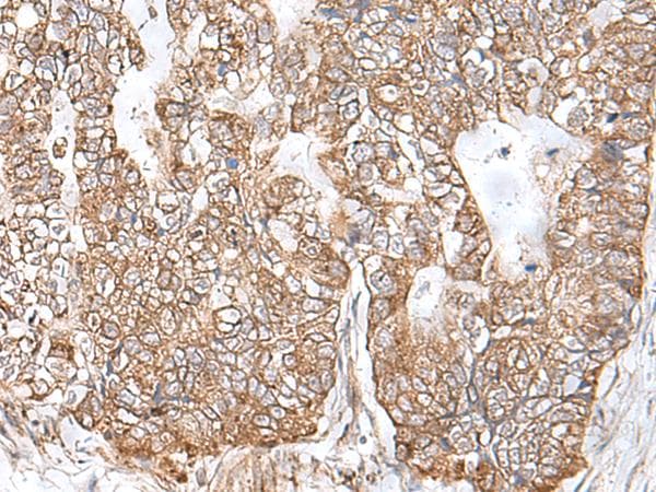 Polyclonal Rabbit anti-Human Arkadia / RNF111 Antibody (IHC)