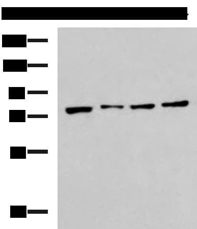 Polyclonal Rabbit anti-Human HSPA5 / GRP78 / BiP Antibody (IHC, WB)