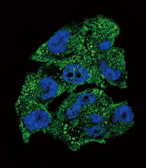 Polyclonal Rabbit anti-Human NME1 / NM23 Antibody (aa25-54, IHC, IF, WB)
