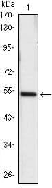 SHH / Sonic Hedgehog Antibody (clone 8G3)