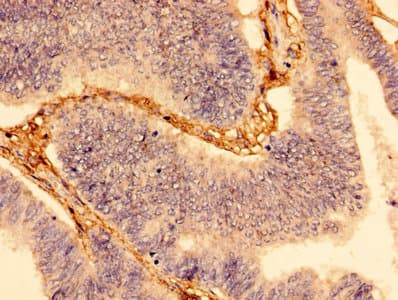 WDFY3 / ALFY Antibody