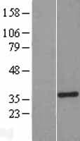 M-PST / STM Protein (Over-Expression Lysate Myc-DDK (Flag))