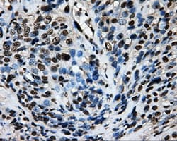 SORD / Sorbitol Dehydrogenase Antibody (clone OTI15H2)