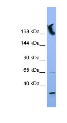 NUP155 Antibody (N-Terminus)
