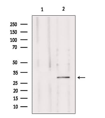 Polyclonal Rabbit anti-Human MRPS15 Antibody (IF, WB)