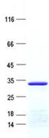 Human BTG4 Protein (Recombinant His, N-Terminal)