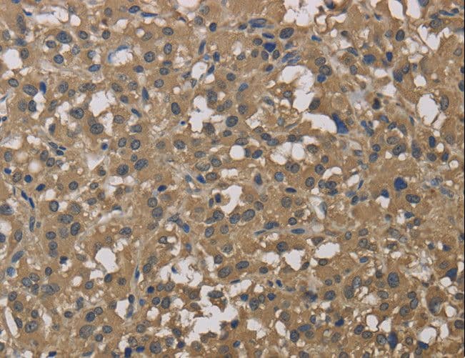 Dynactin 3 / DCTN3 Antibody